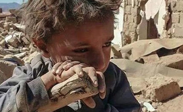 اليـمـن والحـرب العبثـية التي لا تـريد أن تضع أوزارهـا